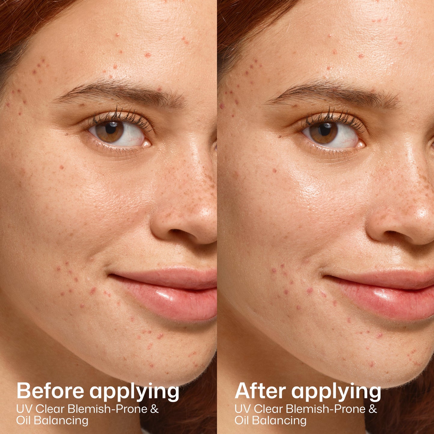 UV Clear Blemish-Prone & Oil Balancing SPF 50
