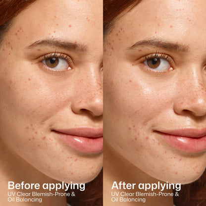 UV Clear Blemish-Prone & Oil Balancing SPF 50