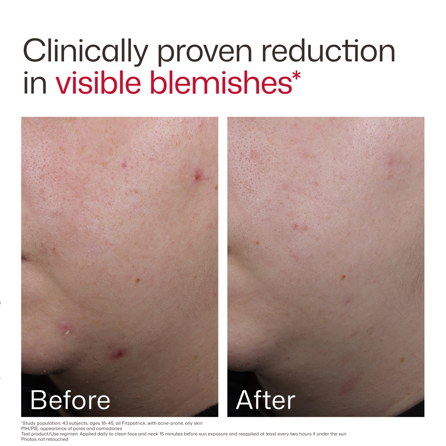 UV Clear Blemish-Prone & Oil Balancing SPF 50